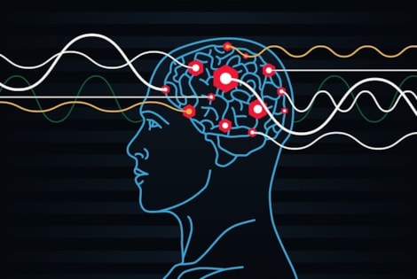 elektroshock