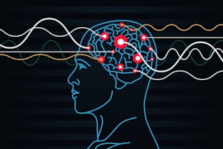 elektroshock