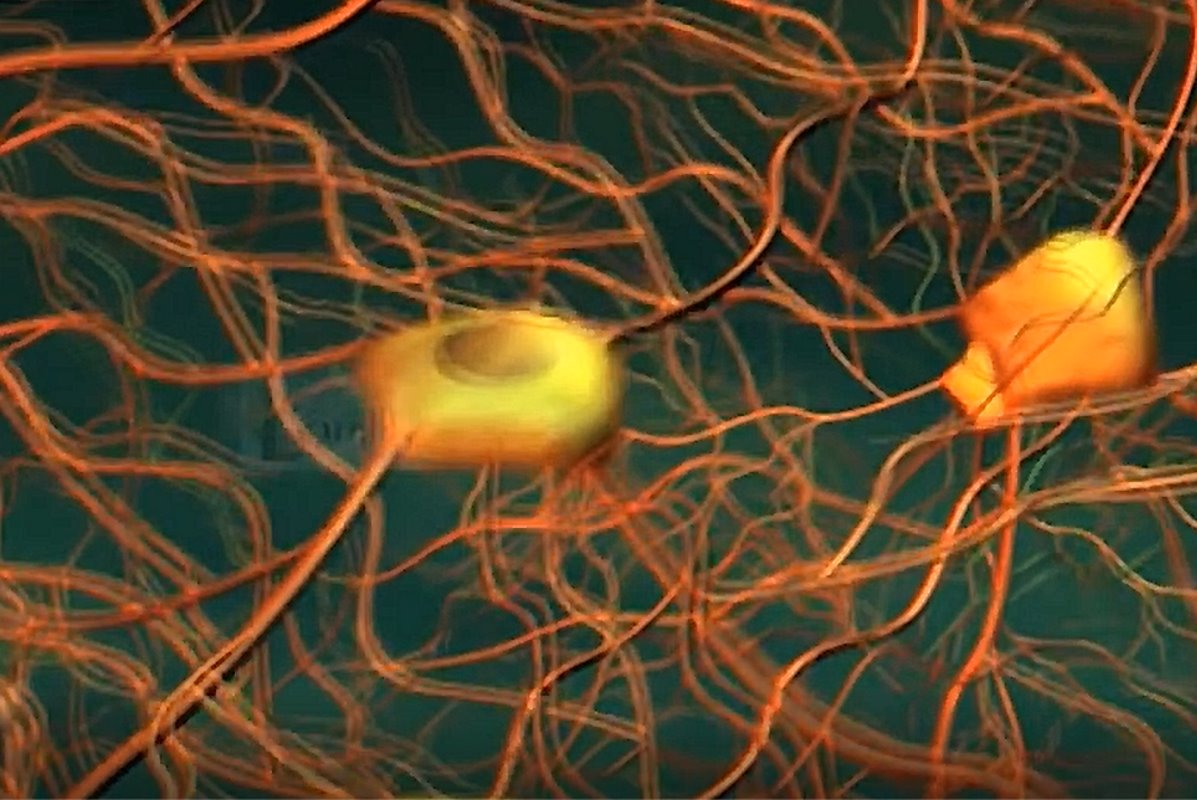 Magnetische 'deep brain stimulation' alternatief voor operatieve methode