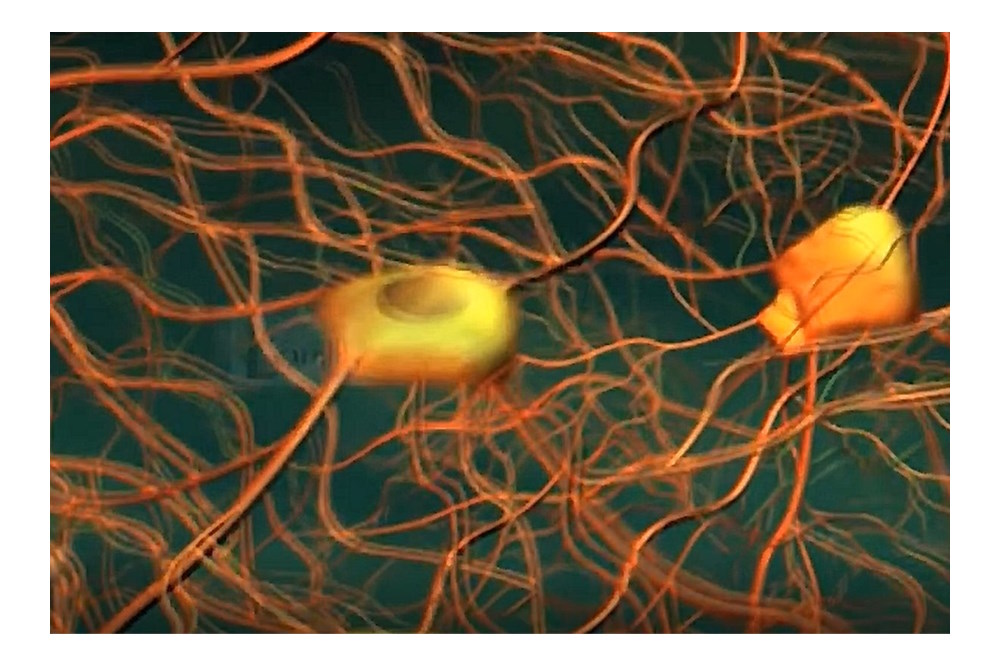 Vorm van hersenen heeft veel grotere invloed dan eerder werd aangenomen