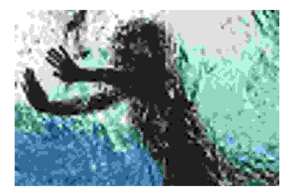 ‘Jeugdtrauma geeft grotere kans op lichamelijke ziektes’