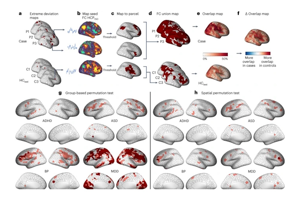 De diversiteit van hersenveranderingen bij psychische aandoeningen beter begrepen